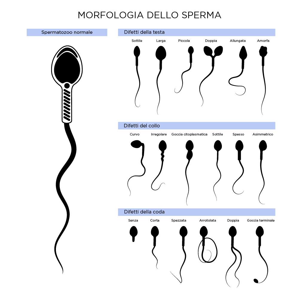 morfologia sperma